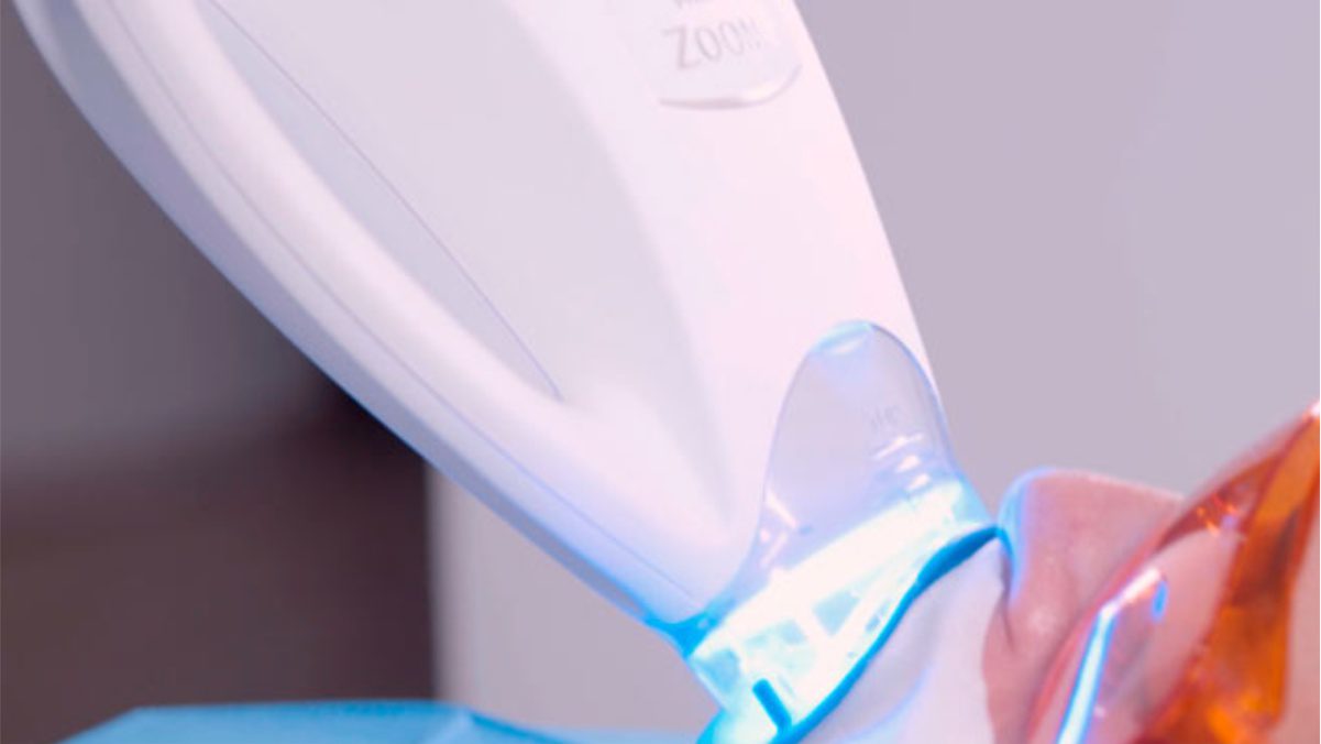 blanqueamiento-dental-Tenerife