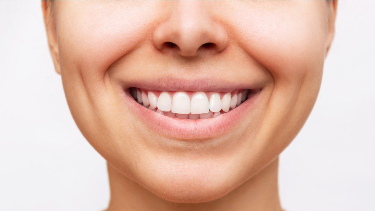 Blanqueamiento-Dental-Tenerife-Clínica-Dental-Brident-odontologos