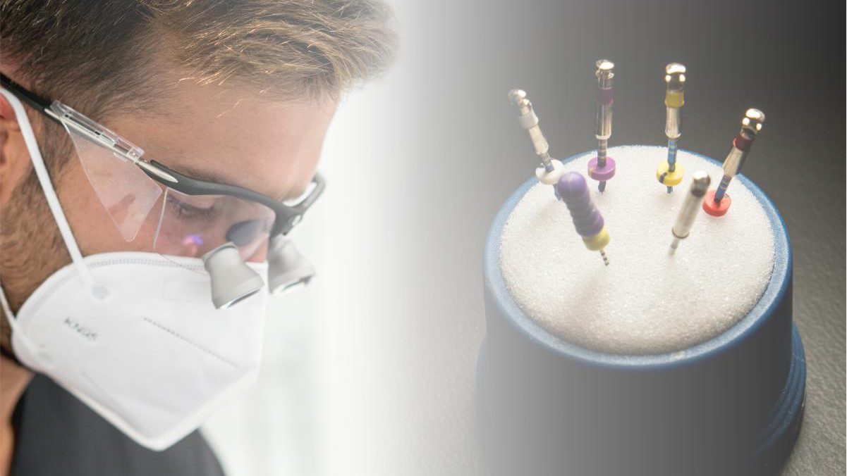 endodoncia-tenerife