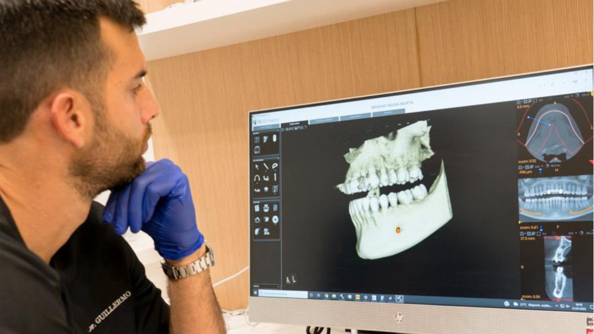 implantes-dentales-tenerife