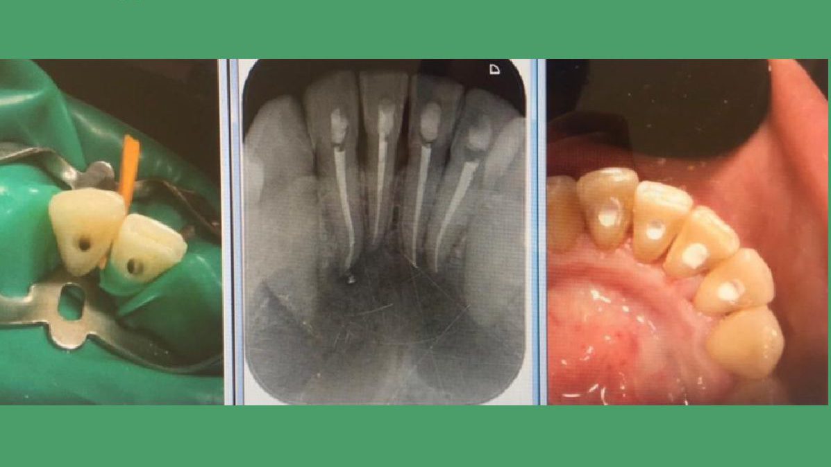 ENDODONCIA TENERIFE