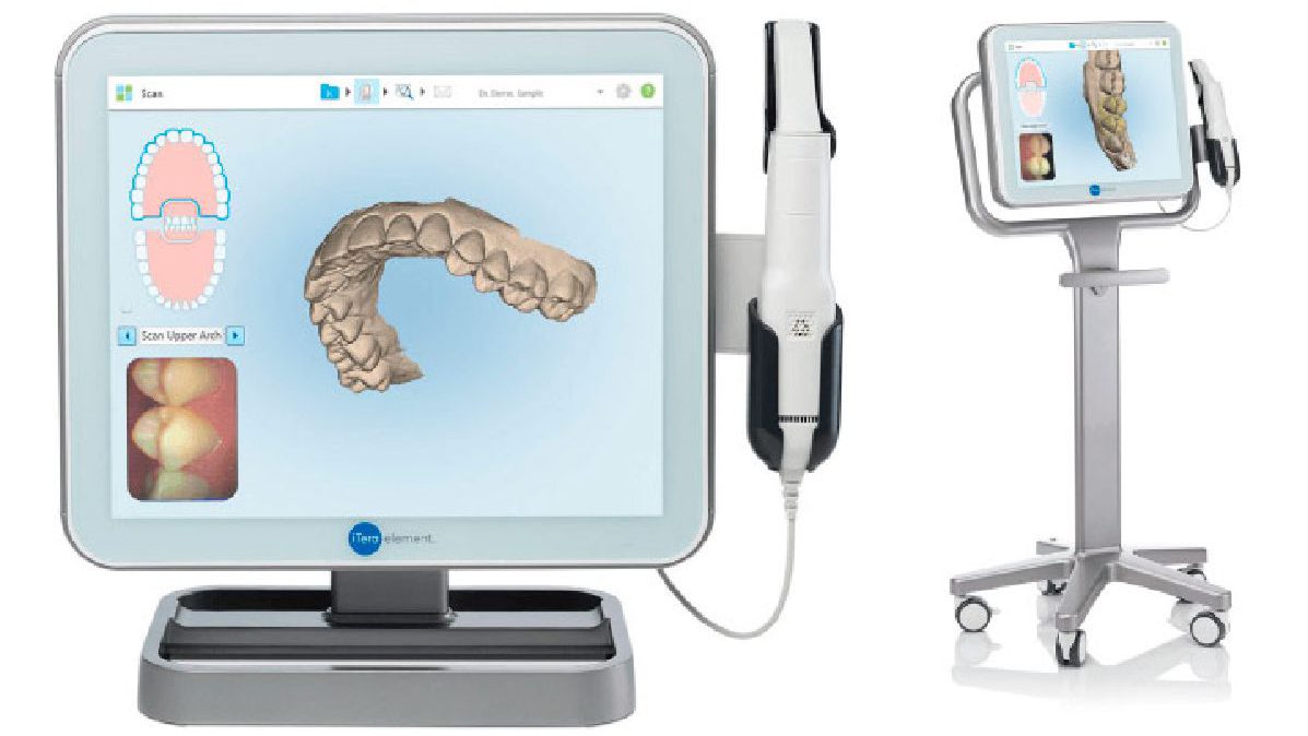 escaner intraoral itero 3d