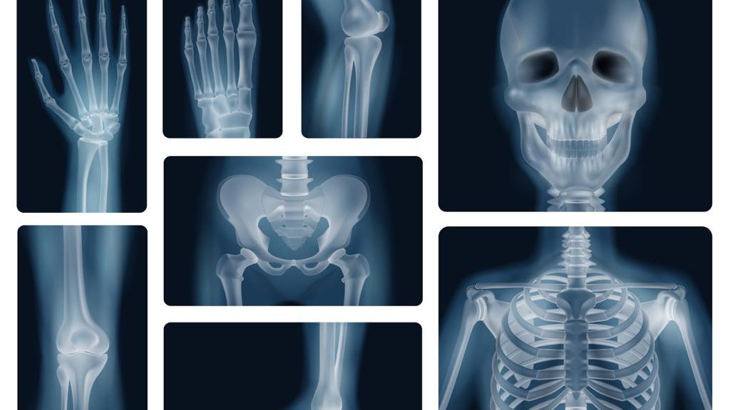 osteoporosis y salud dental
