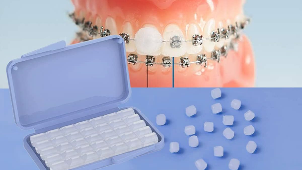 cera dental