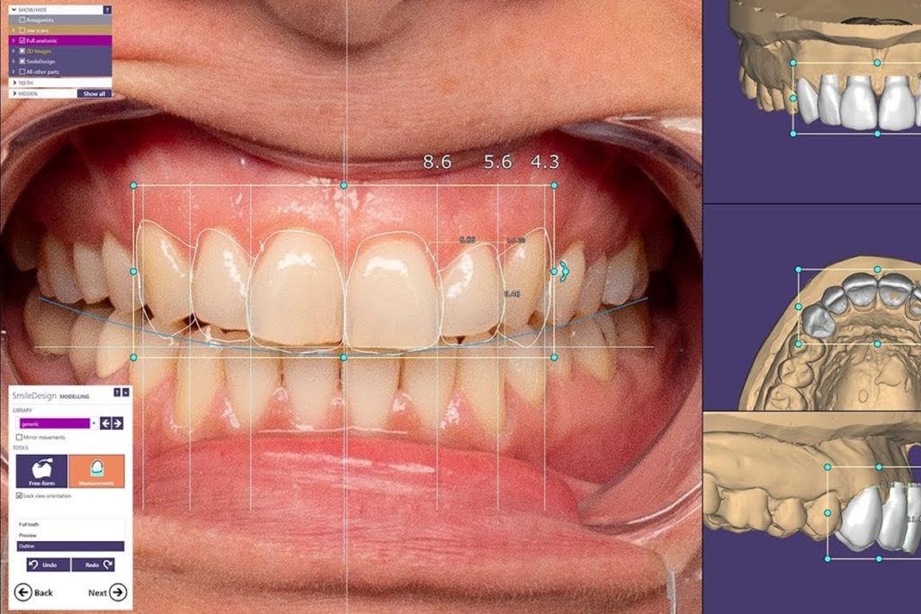 Diseñamos tu sonrisa