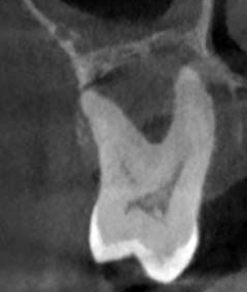 Enfermedad periodontal