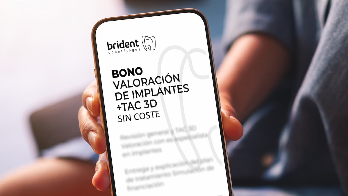 bono implantes más tac 3D sin coste