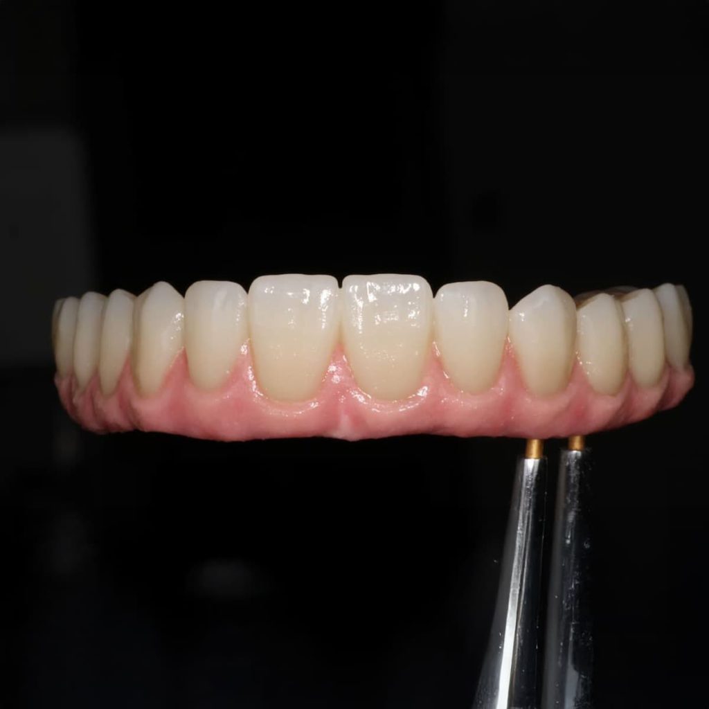 Prótesis dental