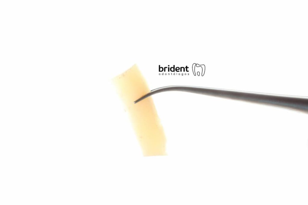 Muestra de Injerto de hueso